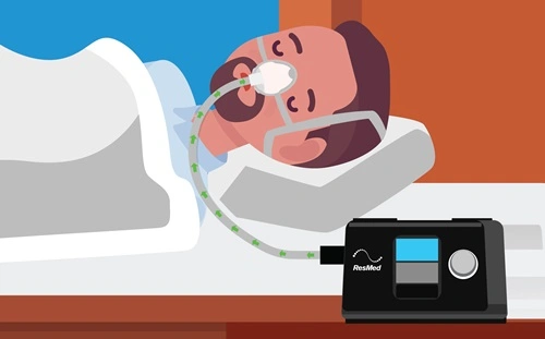 CPAP Pressure